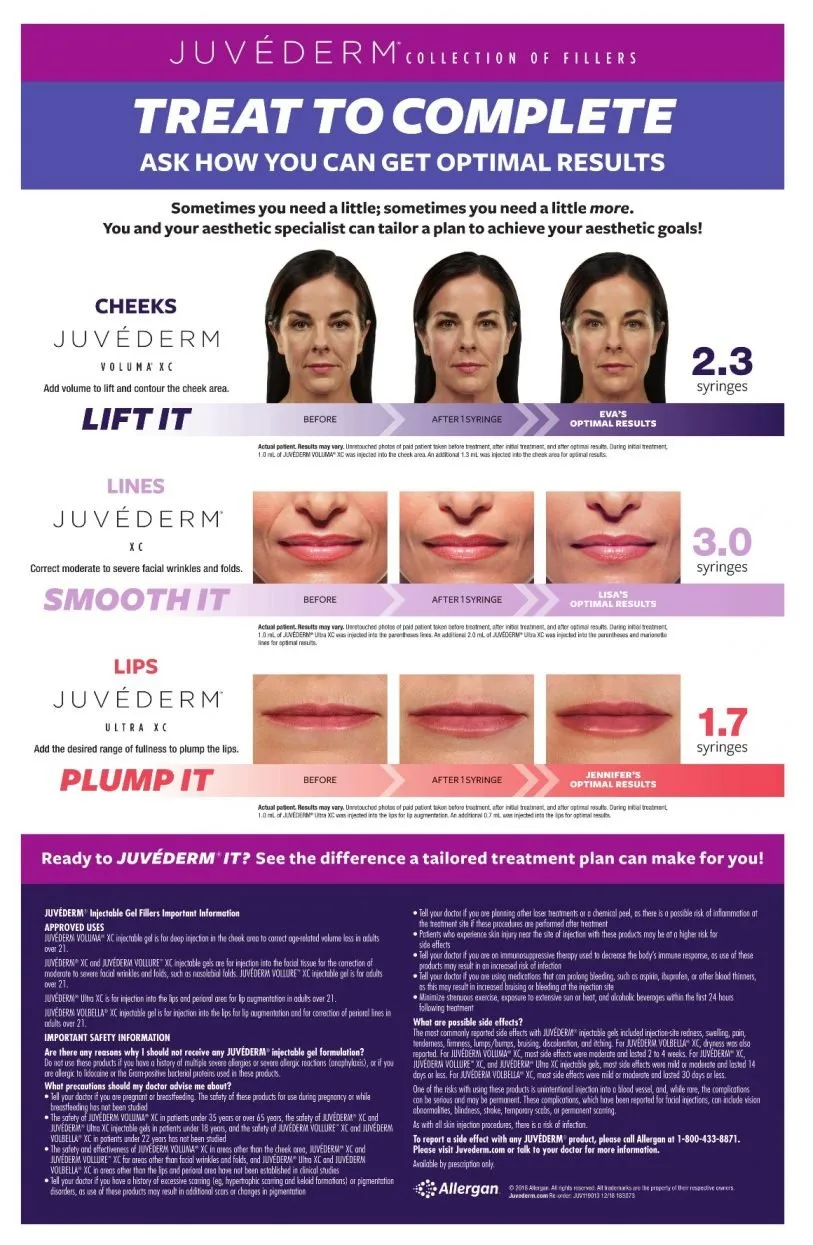 Juvederm infographic